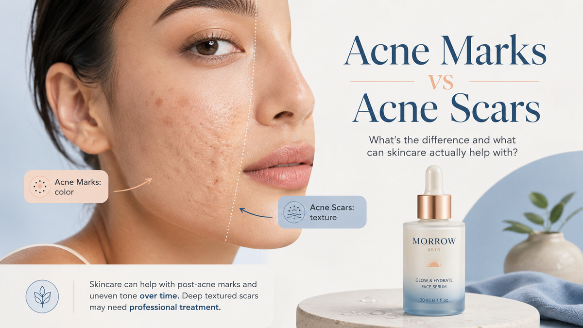 Acne Marks vs Acne Scars: What’s The Difference And What Can Skincare Actually Help With?